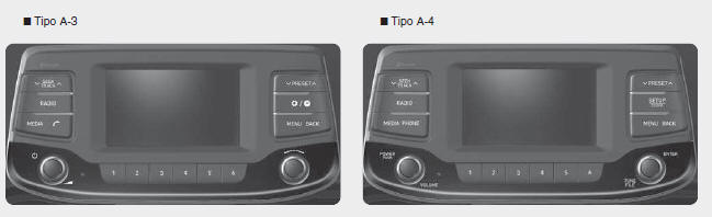 Caratteristiche del Vostro Audio